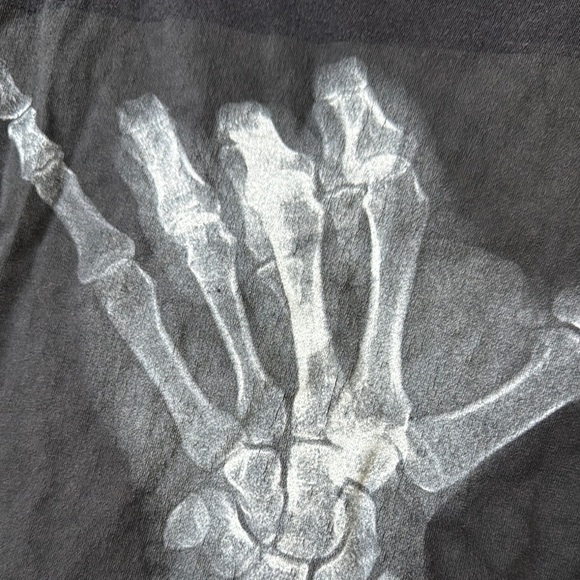 Hurley Black X-Ray Graphic Tee - Picture 2 of 5